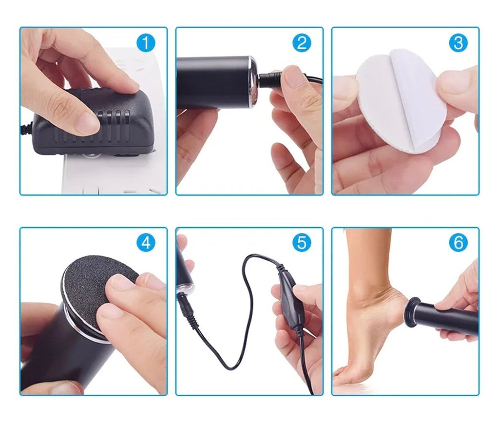 Profisioneller Fuß-Hornhautentferner